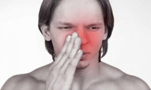 Nasal congestion