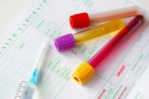 Blood or urine test